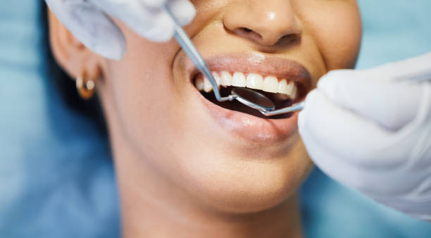 Best Emergency Dental Care for Sports Injuries in Nsfield Center, MA